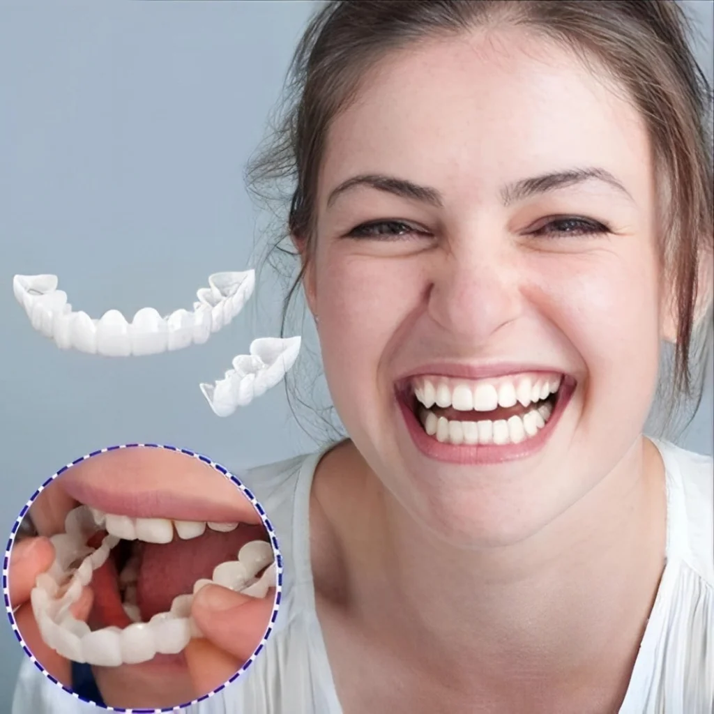Dental Veneers Snap Teeth Veneers Smile Set - Image 10